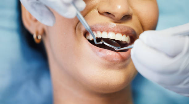 Best Broken or Chipped Tooth Repair in Poinciana, FL